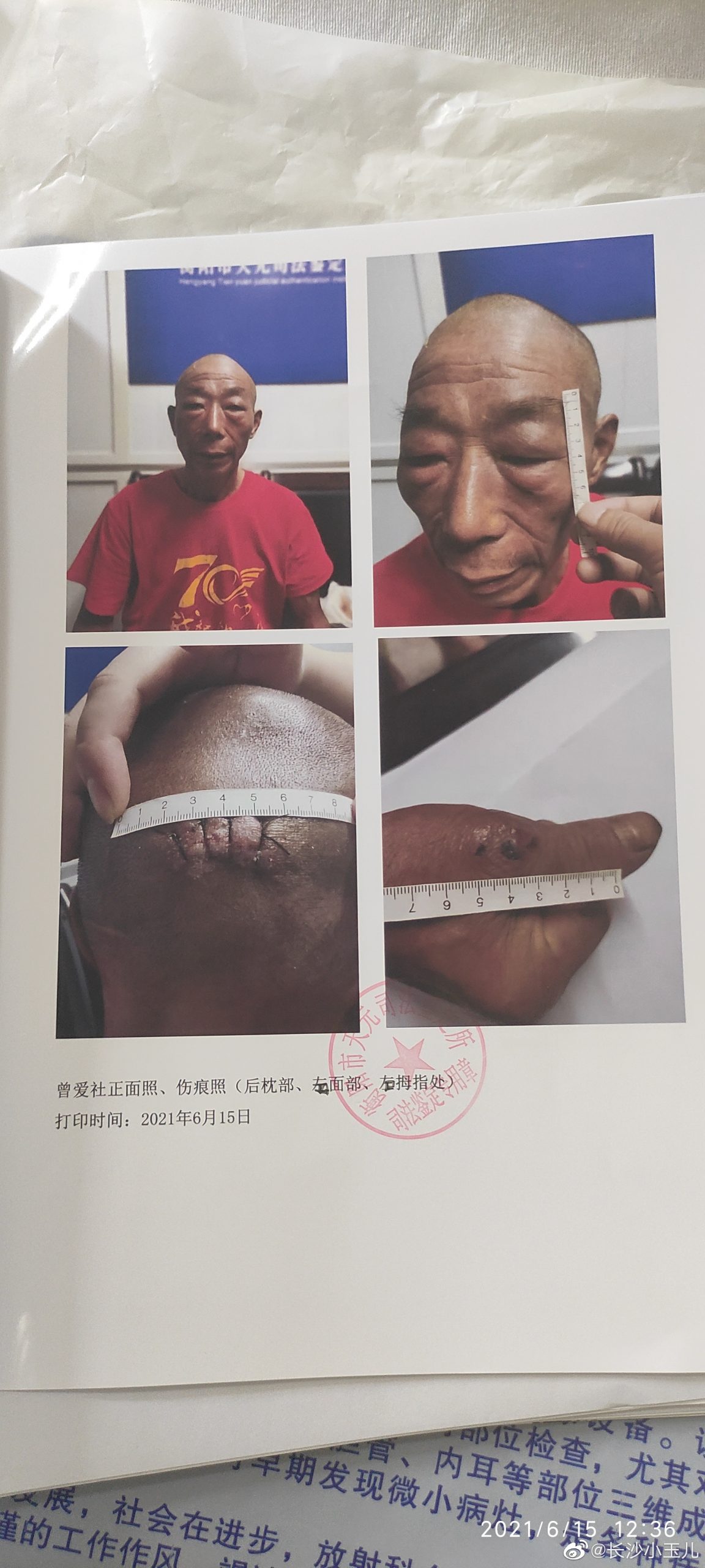 @衡阳寻衅滋事案刑事自诉人